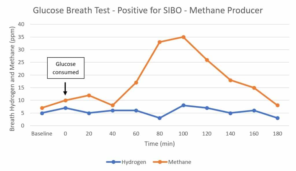 Glucose Breath Test - Positive for SIBO - Methane Producer