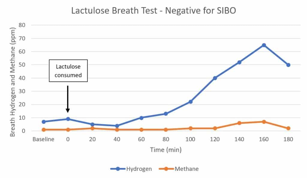 Lactulose Breath Test Results - Negative for SIBO