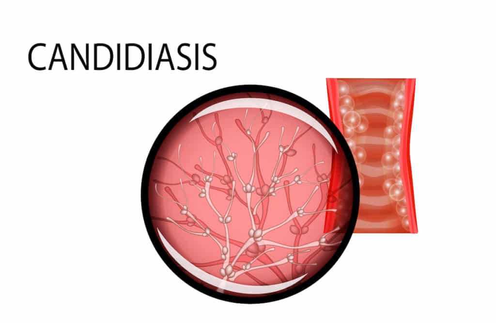 functional nutrition for candida
